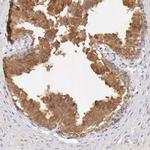 NSDHL Antibody in Immunohistochemistry (IHC)