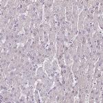 CHRDL1 Antibody in Immunohistochemistry (Paraffin) (IHC (P))