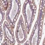 CHRDL1 Antibody in Immunohistochemistry (Paraffin) (IHC (P))