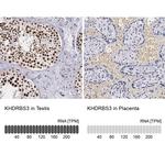 KHDRBS3 Polyclonal Antibody
