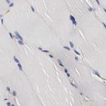 CKAP4 Antibody in Immunohistochemistry (Paraffin) (IHC (P))
