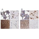 CKAP4 Antibody in Immunohistochemistry (IHC)