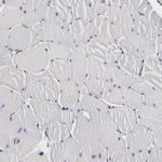 CKAP4 Antibody in Immunohistochemistry (IHC)