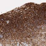 CKAP4 Antibody in Immunohistochemistry (IHC)