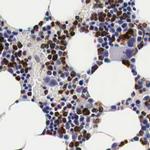CKAP4 Antibody in Immunohistochemistry (IHC)