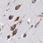 CKAP4 Antibody in Immunohistochemistry (IHC)