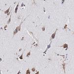 CKAP4 Antibody in Immunohistochemistry (IHC)