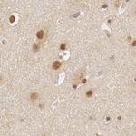 GPKOW Antibody in Immunohistochemistry (Paraffin) (IHC (P))