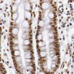 GPKOW Antibody in Immunohistochemistry (Paraffin) (IHC (P))