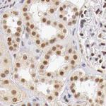 GPKOW Antibody in Immunohistochemistry (Paraffin) (IHC (P))