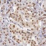 GPKOW Antibody in Immunohistochemistry (Paraffin) (IHC (P))