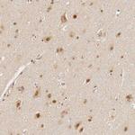 GPKOW Antibody in Immunohistochemistry (IHC)