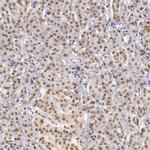 GPKOW Antibody in Immunohistochemistry (IHC)
