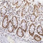 GPKOW Antibody in Immunohistochemistry (IHC)