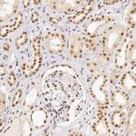 GPKOW Antibody in Immunohistochemistry (IHC)