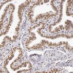 GPKOW Antibody in Immunohistochemistry (IHC)