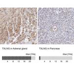 TXLNG Polyclonal Antibody