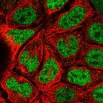 MORC4 Polyclonal Antibody