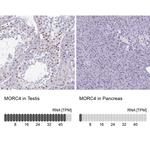 MORC4 Antibody
