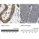 TMX4 Antibody in Immunohistochemistry (IHC)