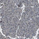TMX4 Antibody in Immunohistochemistry (IHC)