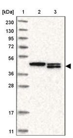 TMX4 Antibody in Western Blot (WB)