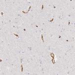 KIAA2022 Antibody in Immunohistochemistry (Paraffin) (IHC (P))