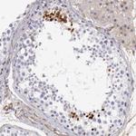 KIAA2022 Polyclonal Antibody