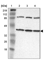 IDH3G Antibody in Western Blot (WB)