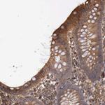 ARMCX4 Polyclonal Antibody