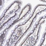 MORC2 Antibody in Immunohistochemistry (Paraffin) (IHC (P))