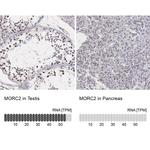 MORC2 Antibody in Immunohistochemistry (IHC)
