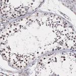 MORC2 Antibody in Immunohistochemistry (IHC)