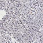 MORC2 Antibody in Immunohistochemistry (IHC)