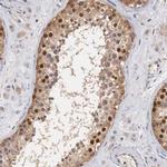 Cyclin B3 Antibody in Immunohistochemistry (IHC)