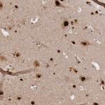 KHDRBS3 Polyclonal Antibody