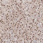 HTATSF1 Antibody in Immunohistochemistry (Paraffin) (IHC (P))