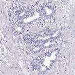 TKTL1 Antibody in Immunohistochemistry (Paraffin) (IHC (P))
