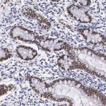 HMGN5 Antibody in Immunohistochemistry (Paraffin) (IHC (P))