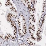 HMGN5 Antibody in Immunohistochemistry (Paraffin) (IHC (P))
