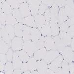 HMGN5 Antibody in Immunohistochemistry (Paraffin) (IHC (P))