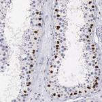 HMGN5 Antibody in Immunohistochemistry (IHC)