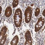 XPNPEP3 Antibody in Immunohistochemistry (IHC)