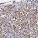 XPNPEP3 Antibody in Immunohistochemistry (IHC)