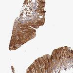 PITPNB Antibody in Immunohistochemistry (Paraffin) (IHC (P))