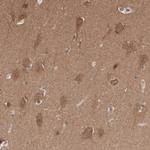 PDXP Antibody in Immunohistochemistry (IHC)