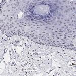 PDXP Antibody in Immunohistochemistry (IHC)