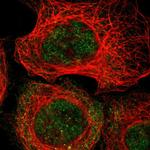 MAST4 Polyclonal Antibody