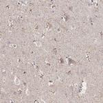 NREP Polyclonal Antibody