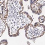 NREP Antibody in Immunohistochemistry (Paraffin) (IHC (P))